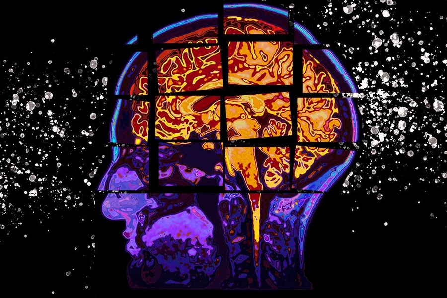 Revolutionary AI Model Accurately Forecasts Alzheimer's Cognitive Decline Up to Two Years in Advance