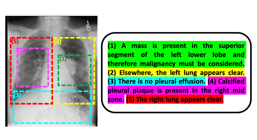 Revolutionizing Medical Image Analysis: How AI Leverages Historical Radiology Reports for Accurate Diagnostics